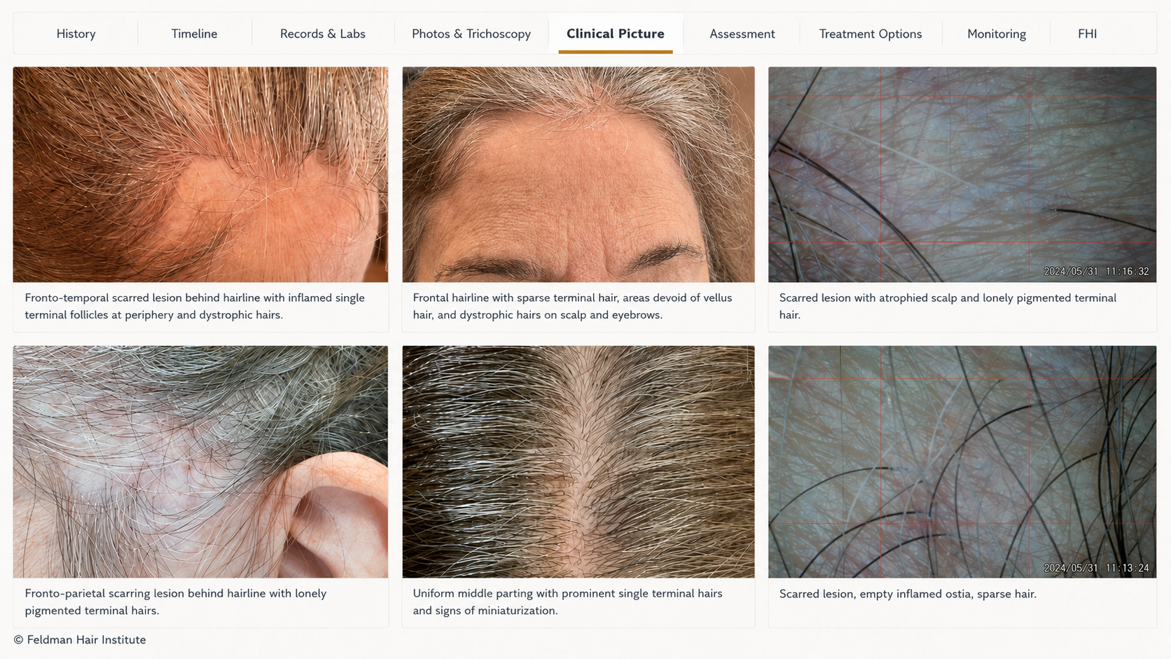 FHI Clinical Picture case review showing clinical photographs and trichoscopy within an integrated hair-loss assessment.
