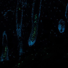 Fluorescence microscopy of hair follicles showing GFP-labelled signalling activity.